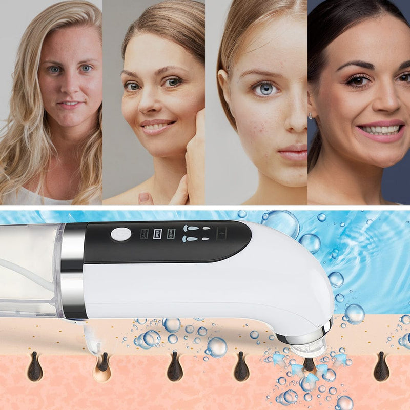 Removedor de Cravos - Bubble Beauty™